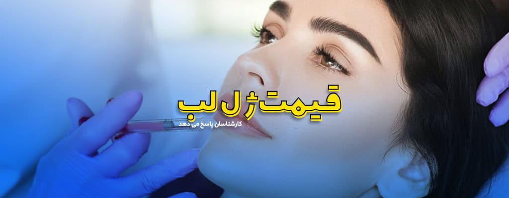 قیمت ژل لب